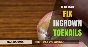 Can Nail Salons Fix Ingrown Toenails? Expert Insights and Advice
