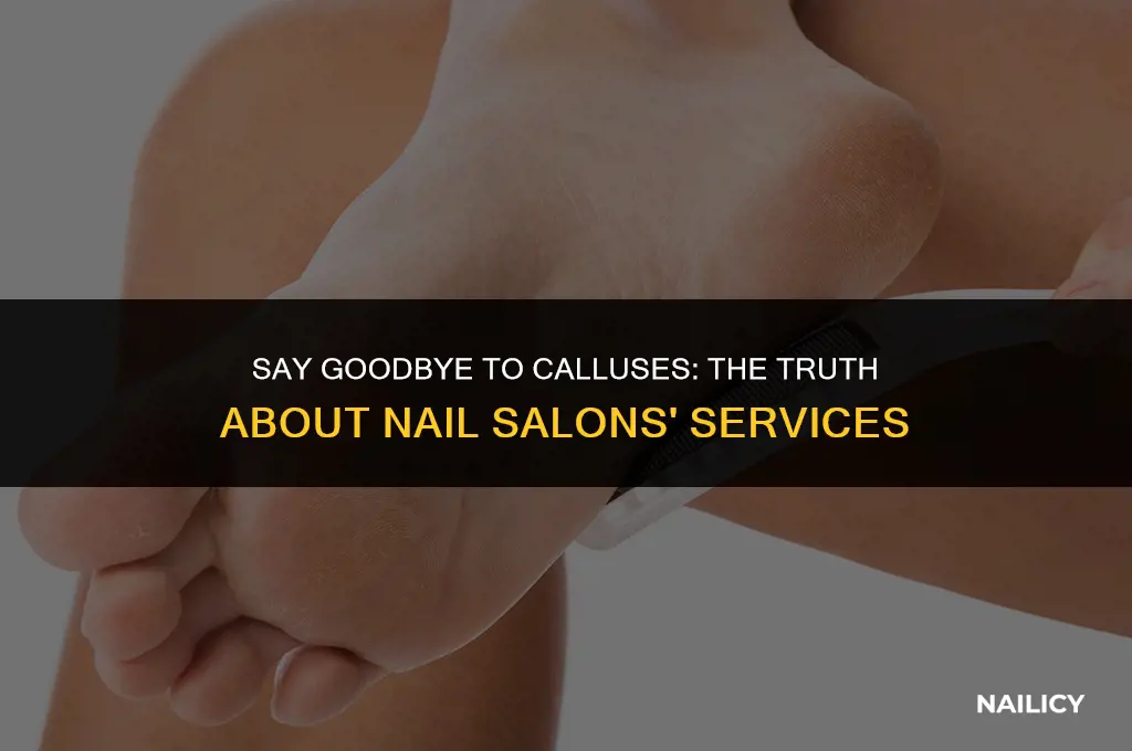 do nail salons get rid of calluses