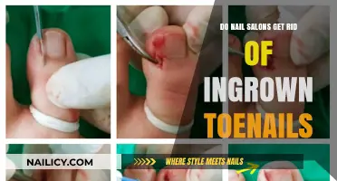 Say Goodbye to Ingrown Toenails: Nail Salons' Expert Solutions