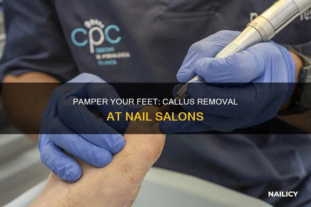 do nail salons remove calluses