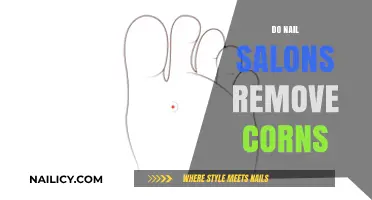 How Nail Salons Treat Corns and Calluses