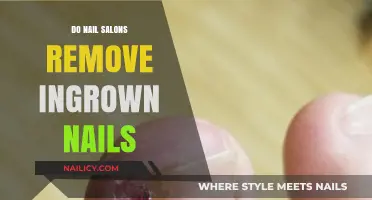 Ingrown Nails: Can Nail Salons Help?