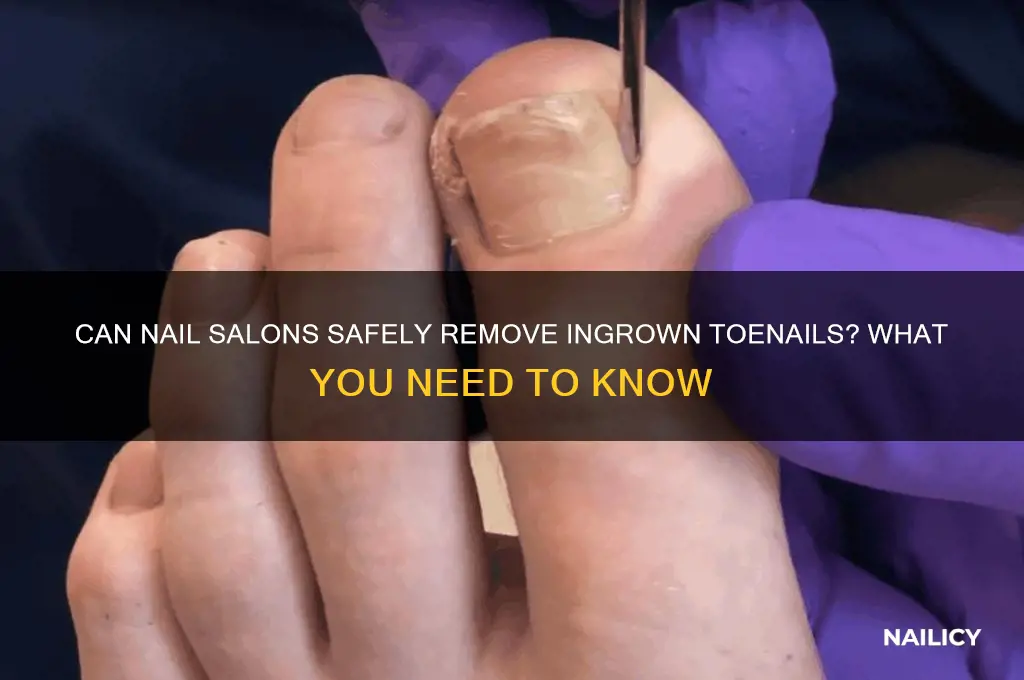 do nail salons take out ingrown toenails