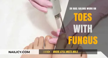 Can Nail Salons Treat Toenail Fungus? What You Need to Know