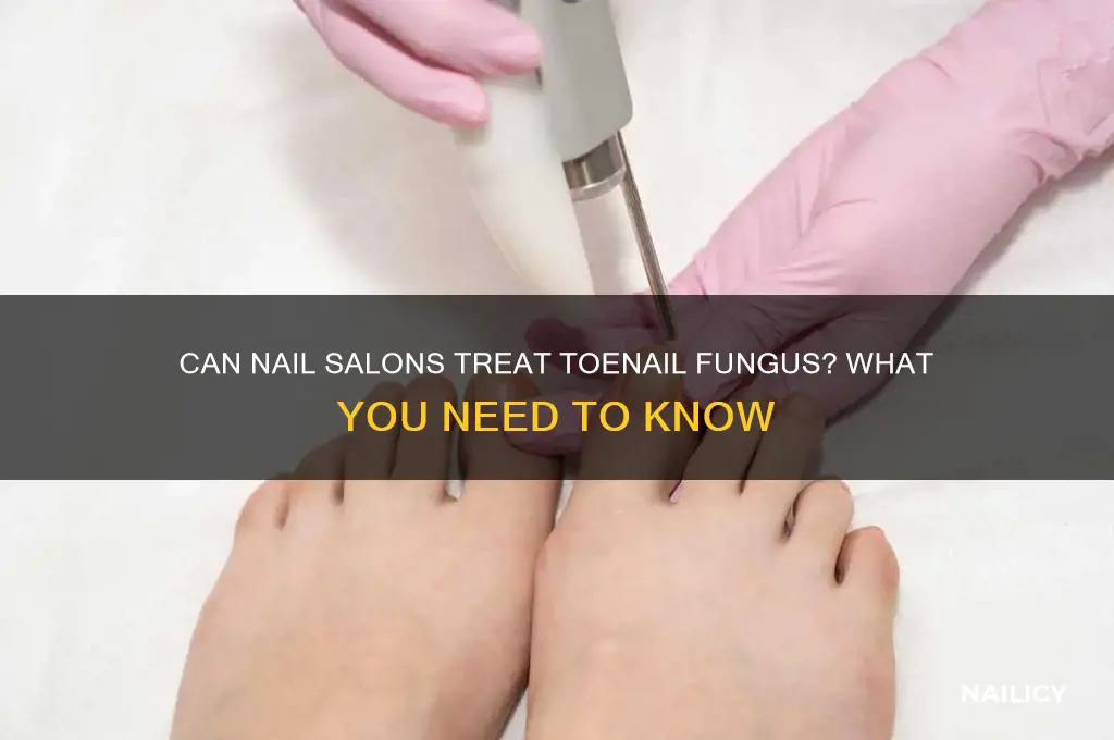 do nail salons work on toes with fungus