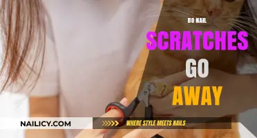 Do Nail Scratches Fade? Healing Tips and Timeframe Revealed