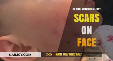 Do Nail Scratches on the Face Lead to Permanent Scars?