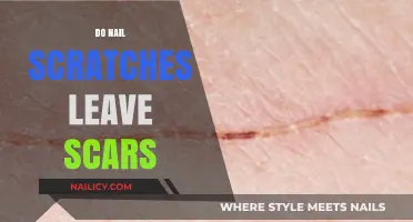 Do Nail Scratches Leave Scars? Healing, Prevention, and Long-Term Effects