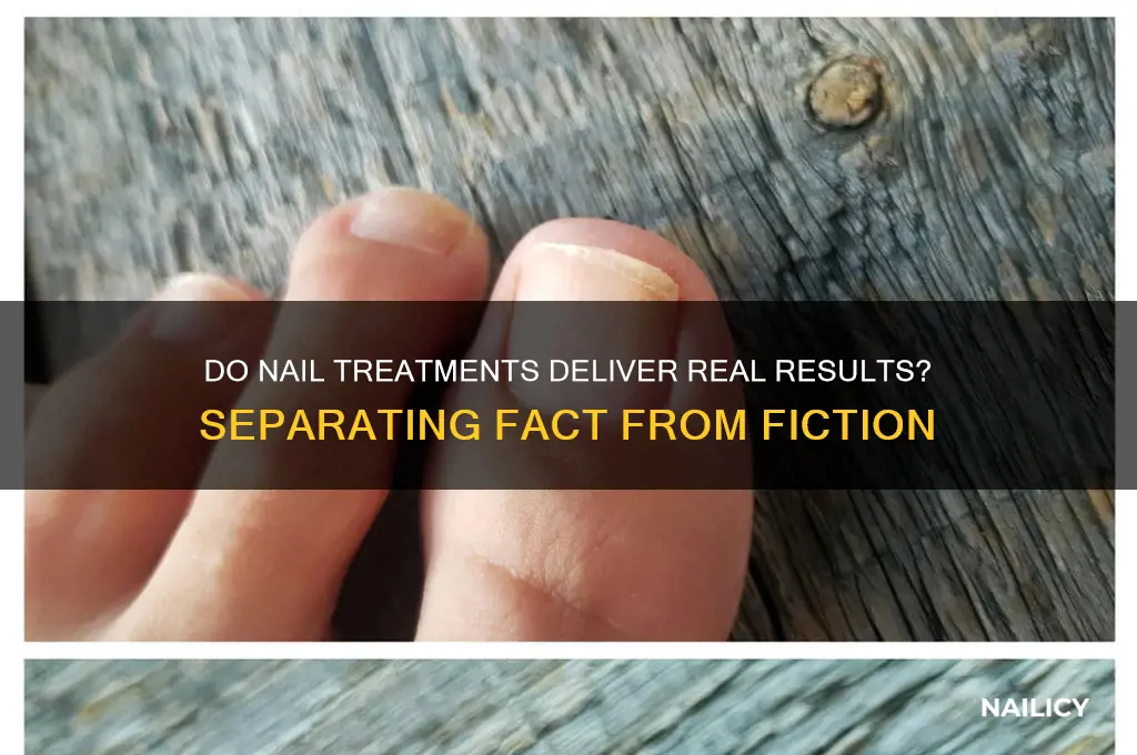 do nail treatments actually work