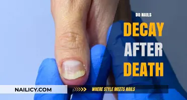 Do Nails Decay After Death? Understanding Postmortem Changes