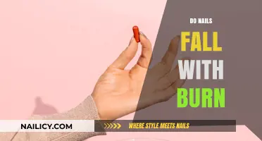 Do Nails Fall Off After Burns? Understanding Burn Injury Effects