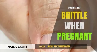 Nail Health During Pregnancy: Understanding Brittle Nails