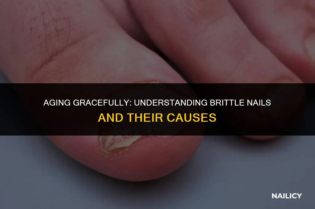 do nails get brittle with age