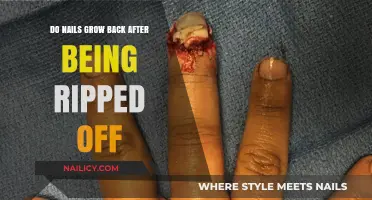 Will Nails Grow Back After Being Ripped Off?