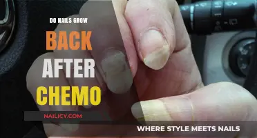 Nail Recovery: Post-Chemo Nail Growth and Care