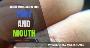 Hand, Foot, and Mouth: Will Nails Grow Back?