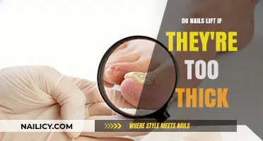 Thick Nails: Do They Lift? Causes, Prevention, and Solutions