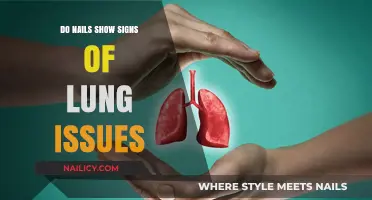 Nail Changes: Uncovering Potential Links to Lung Health Issues