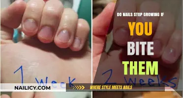 Nail Biting: Does It Stop Nail Growth?