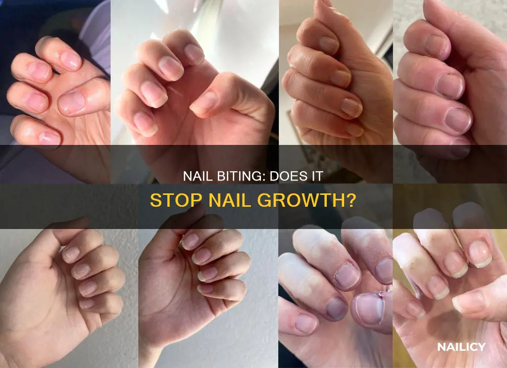 do nails stop growing if you bite them