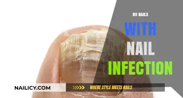 Treating Nail Infections: Safe and Effective Ways to Care for Infected Nails
