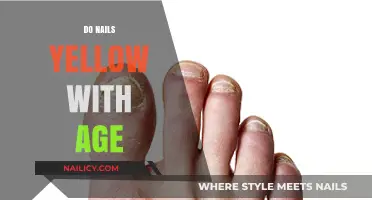 Why Nails Yellow with Age: Causes, Prevention, and Solutions Explained