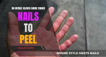 Nitrile Gloves and Peeling Nails: Uncover the Truth