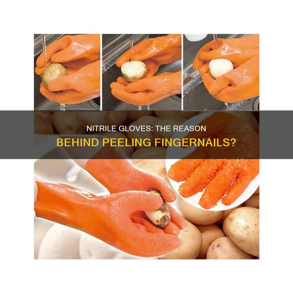 do nitrile gloves cause finger nails to peel