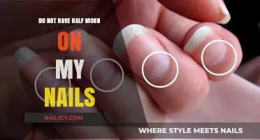 Missing Half Moons on Nails: Causes and What They Indicate