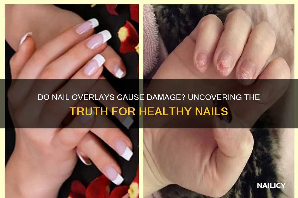 do overlays damage your nails