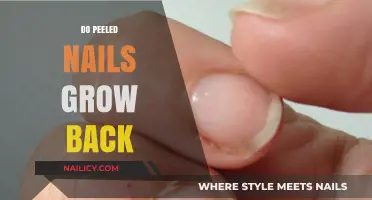 Peeled Nails: Can They Grow Back?