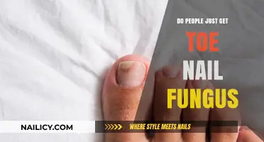 Understanding Toenail Fungus: Causes, Symptoms, and Effective Treatments