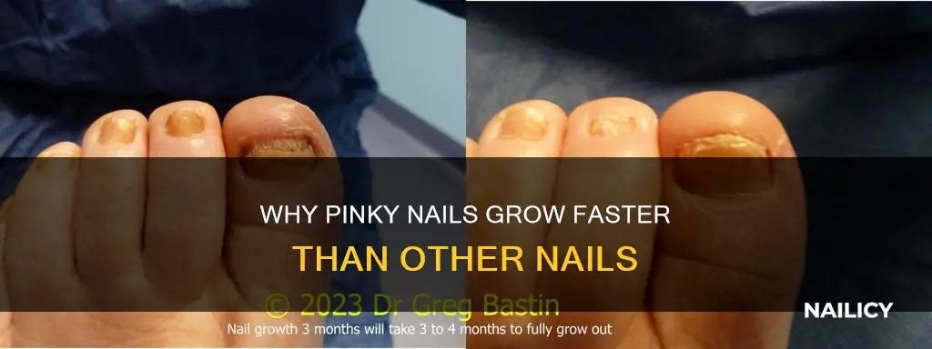 do pinky nails grow faster