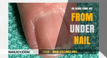 Scabs Under Nails: Causes, Healing Process, and When to Worry