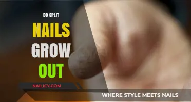 How to Heal and Grow Out Split Nails