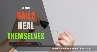 Can Split Nails Heal on Their Own? Expert Insights and Tips