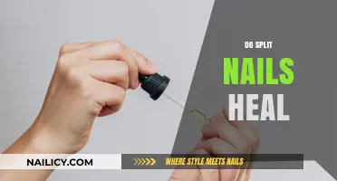 Can Split Nails Heal? Understanding Repair and Prevention Tips