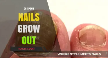How Spoon Nails Grow Out: A Guide