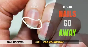 Do Stained Nails Go Away? Causes, Remedies, and Prevention Tips