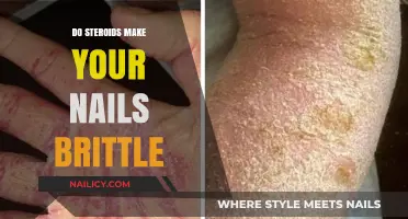 Steroids: The Ugly Side-Effect on Nails