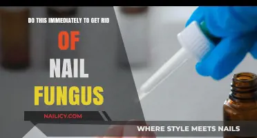 Banish Nail Fungus Fast: Effective Remedies to Try Now