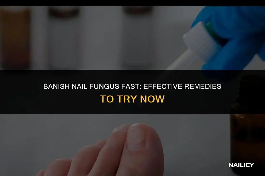 do this immediately to get rid of nail fungus