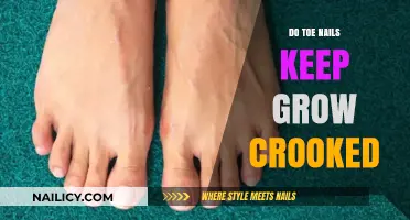 Toe Nails: Why Do They Grow Crooked?