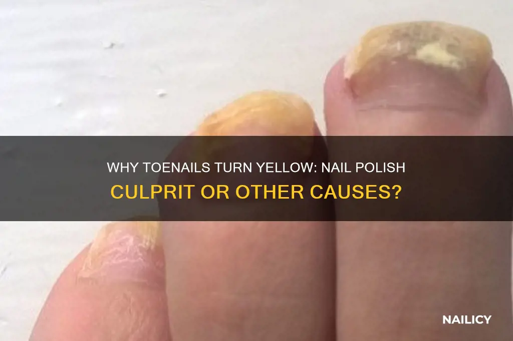 do toenails turn yellow from nail polish