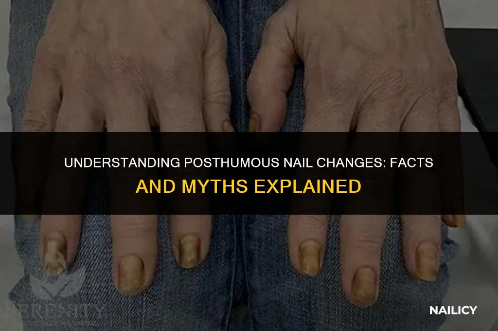 do u get hard nails when you die