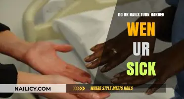 Do Your Nails Harden When You're Sick? Unraveling the Mystery