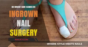 Ingrown Toenail Surgery at Urgent Care: What You Need to Know