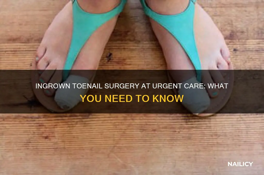 do urgent care clinics do ingrown nail surgery