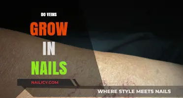 Veins in Nails: What Does it Mean?