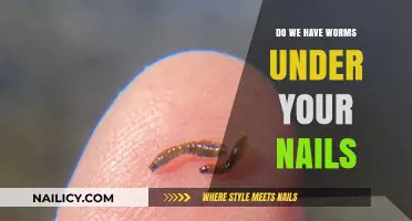 Unseen Dangers: Do We Have Worms Lurking Under Our Nails?